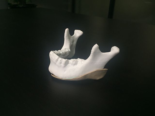 技術(shù)指南 | 3D打印技術(shù)之FDM熔融沉積成型技術(shù)