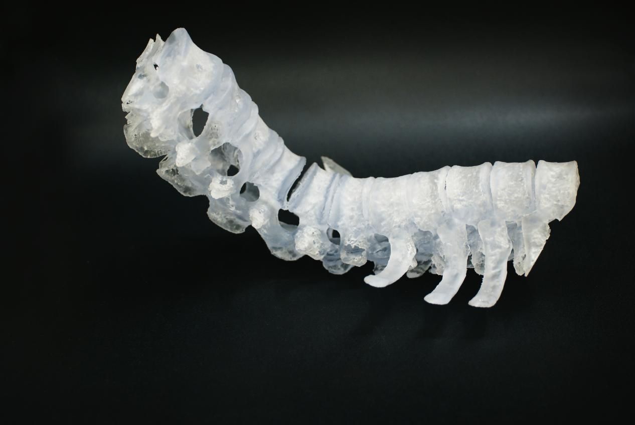 3d打印技術在醫(yī)療領域的應用之骨科應用