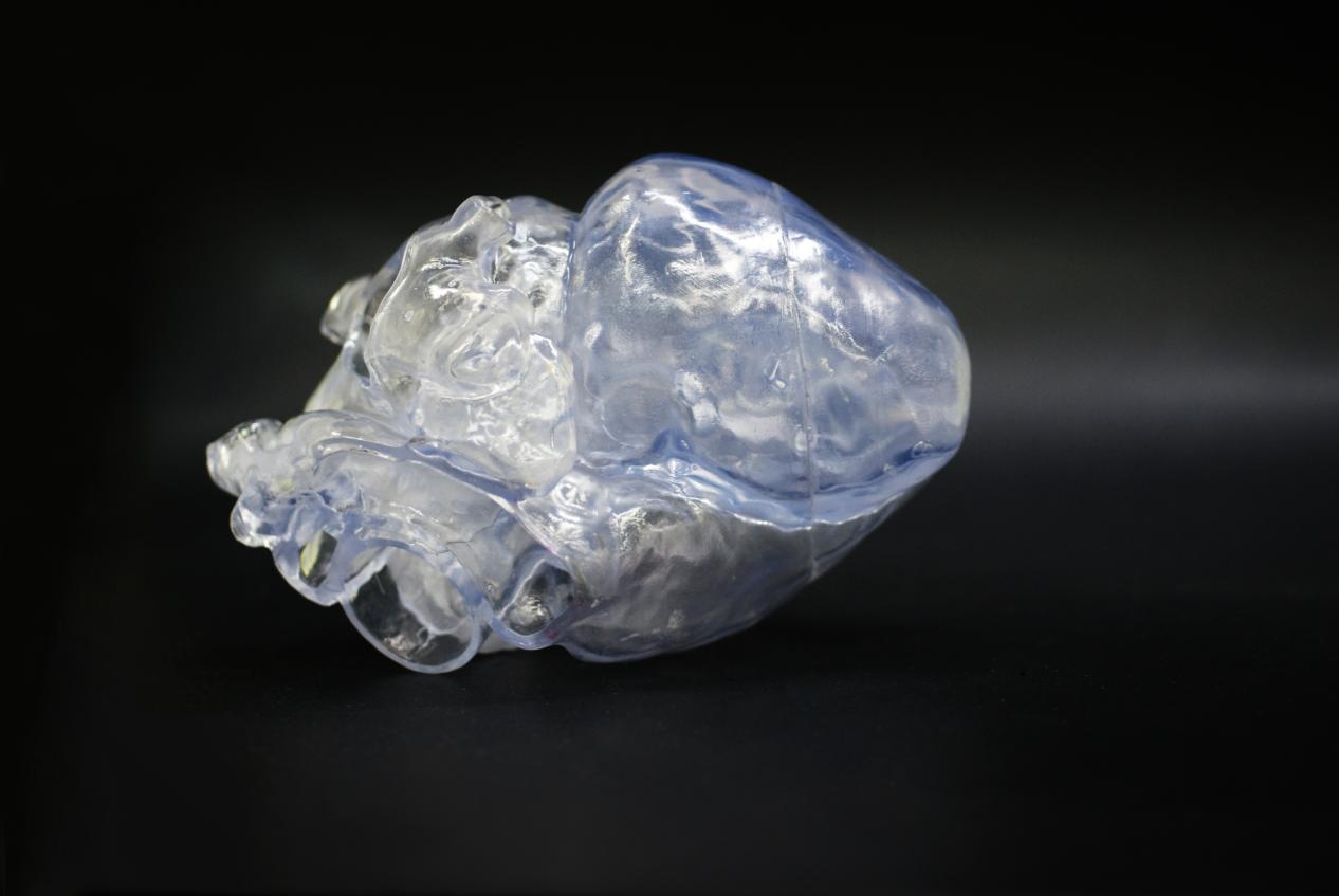 增材制造3d打印在醫(yī)療領(lǐng)域的應(yīng)用